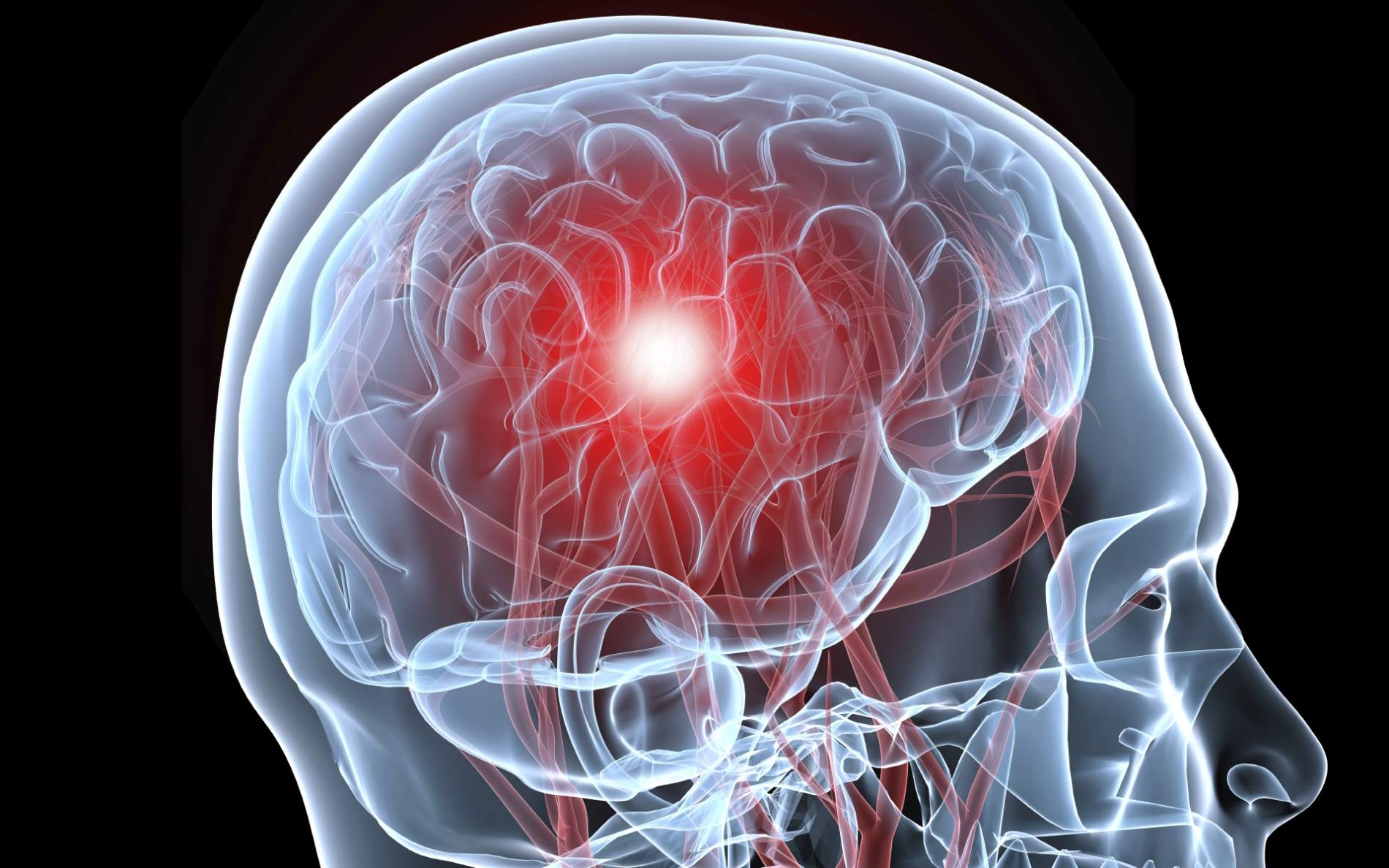 Top 10 Lethal Diseases in World